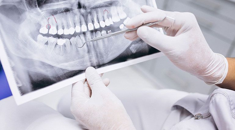 Why Some People Almost Always Save Money With cost of composite fillings